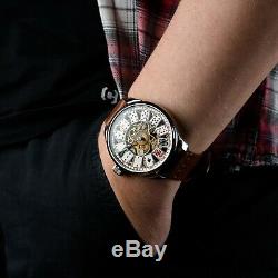 Pre-Order Omega marriage skeleton antiques pocket watch in art deco case dial